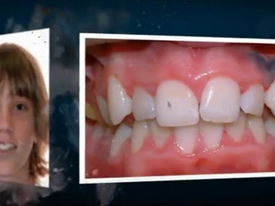 Orthodontist Greeley:  Smiles From The Smile Specialist