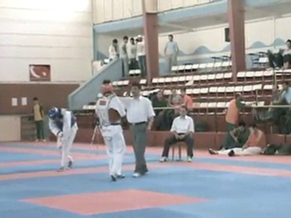 Esra Akbas'in Eli Kırıldı.