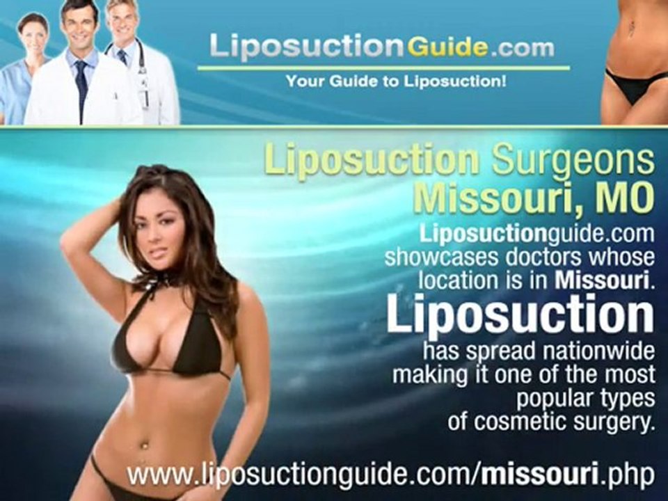 Liposuction Missouri