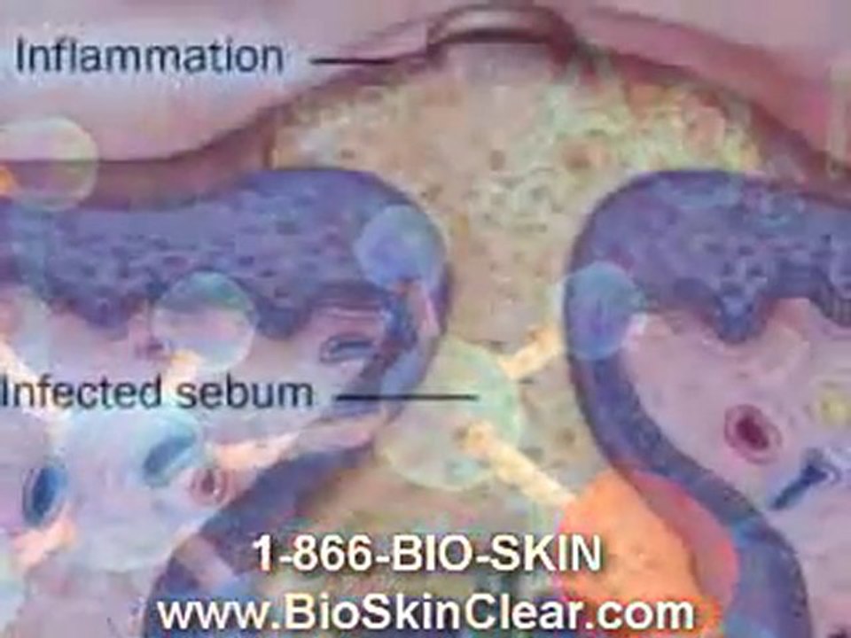 08-www.bioskinclear.com-Bioskin Clear