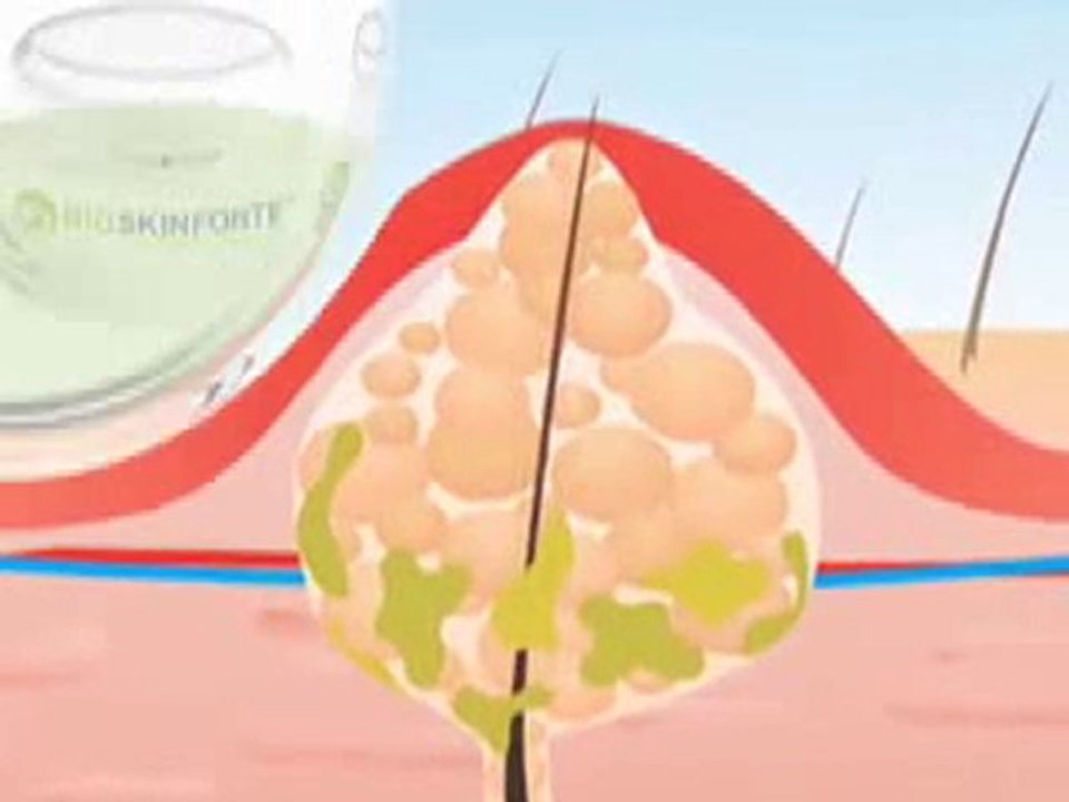 11-www.bioskinclear.com_BIOSKINFORTE
