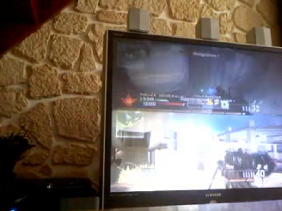 INTERVENTION vs ACR lunette ACOG