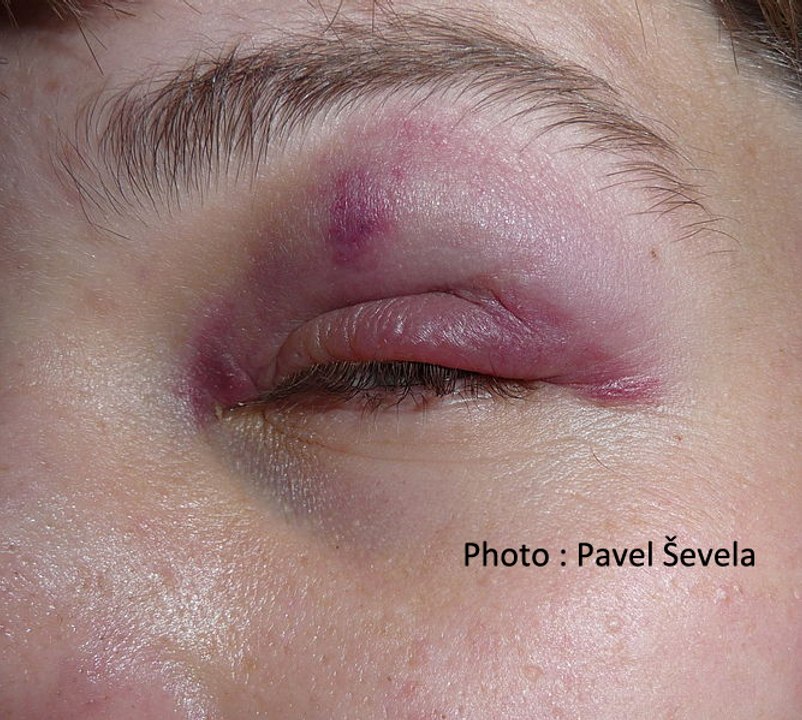 Violences conjugales. Comment porter plainte ?