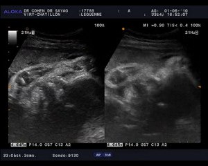 17788_20100601_Obst-U3eme-U_0002 echo 1er juin