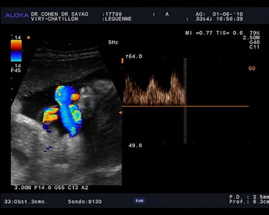 17788_20100601_Obst-U3eme-U_0005 echo 1er juin