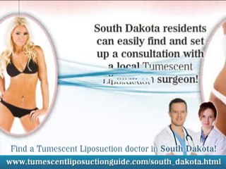 Tumescent Liposuction South Dakota