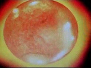 Fast Dreams - Pascal Cobra