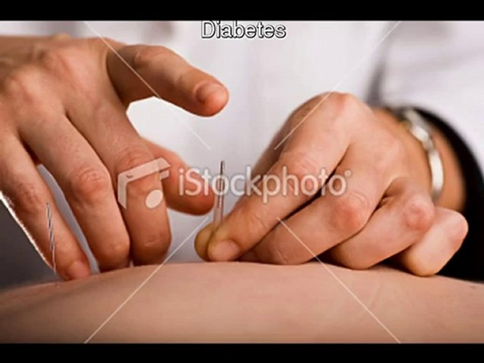 medicina alternativa df, acupuntura df, acupunturistas en e