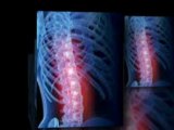 Tucson Chiropractic - 3 Causes of Neck Pain