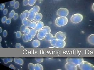 Darkfield Live Blood Analysis shows how AOX fights free radicals instantly