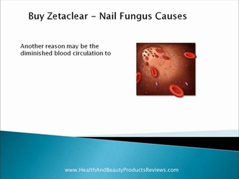 Buy Zetaclear - Nail Fungus Causes