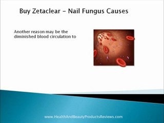 Buy Zetaclear - Nail Fungus Causes