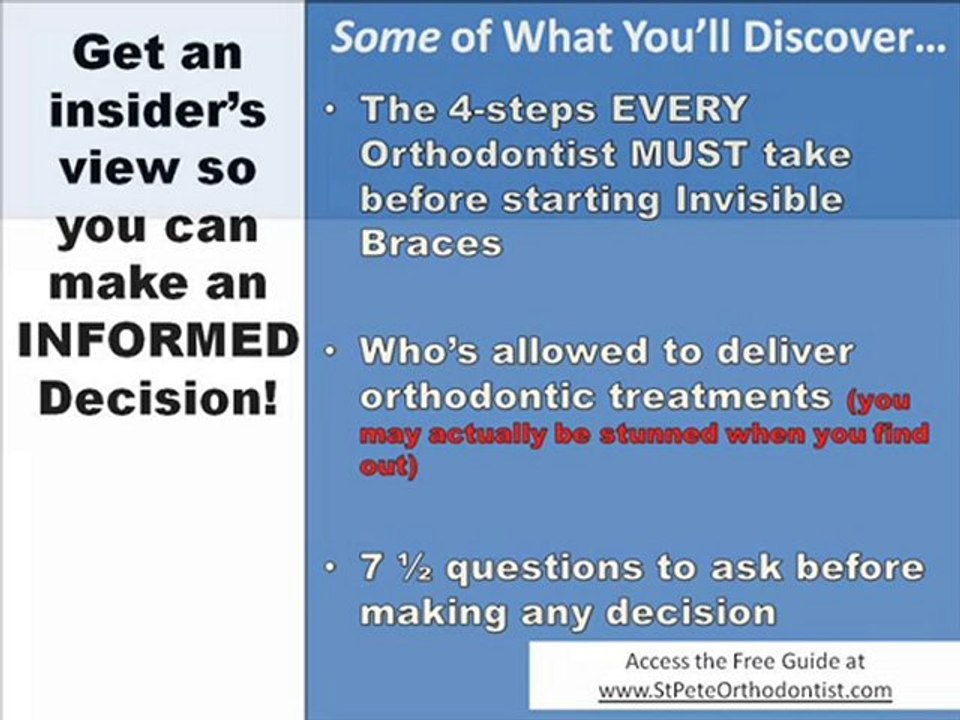 Invisible Braces St Petersburg - Insiders Guide to the BEST