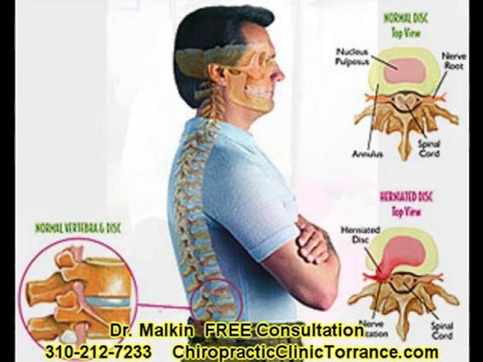 Chiropractic Clinic Torrance | Chiropractic Adjustment Torra