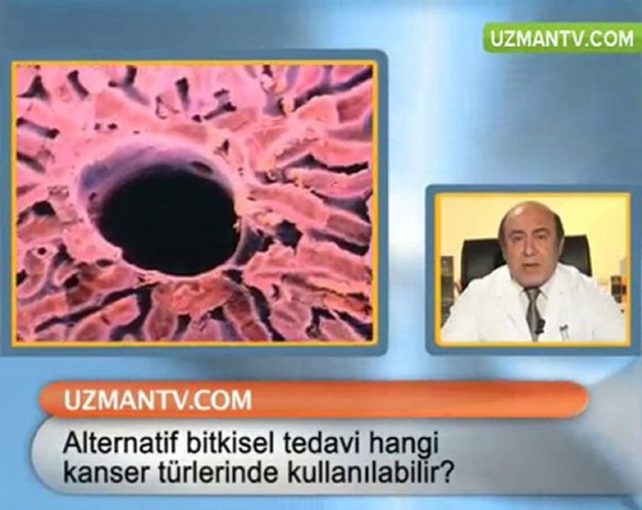 Alternatif bitkisel tedavi hangi kanser türlernde kullanılır