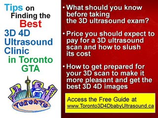 How to get the best 3D ultrasound in Toronto