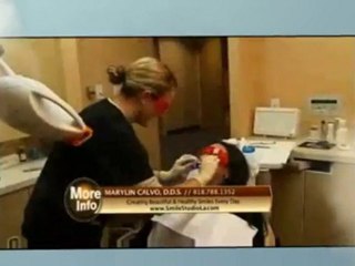 Los Angeles Porcelain Onlays-Beverly Hills Porcelain Onlays