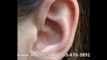 Digital Hearing Aids Sterling VA - Affordable Hearing Aids