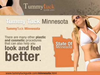 Tummy Tuck Minnesota