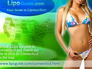 Lipo Doctors in Connecticut | Find Local Specialists