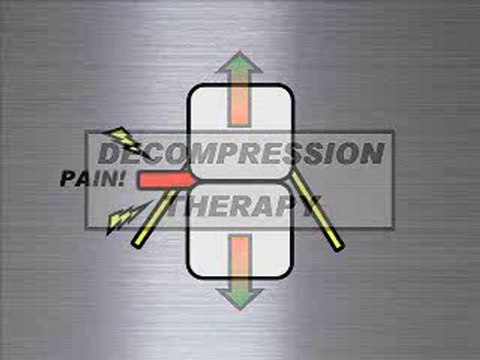 Spinal decompression in San Diego information