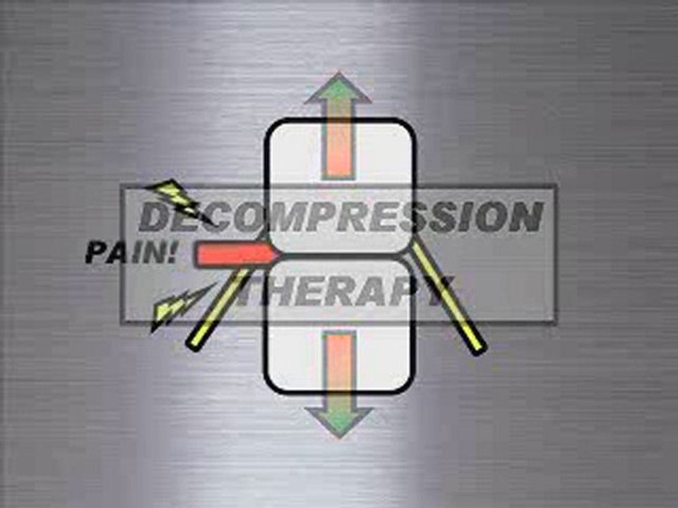 Spinal decompression in San Diego information