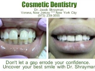 New York City Cosmetic Dentist - Dr. Jacob Shrayman