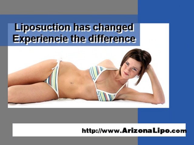 Arizona Liposuction