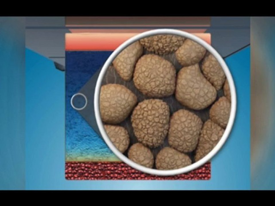 Zeltiq, a non-invasive body contouring procedure, ...