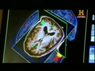 Resonancia magnetica funcional (RMf): Fruta vs. coches