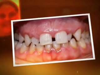 Greeley Orthodontist - Super Smiles By Doctor K