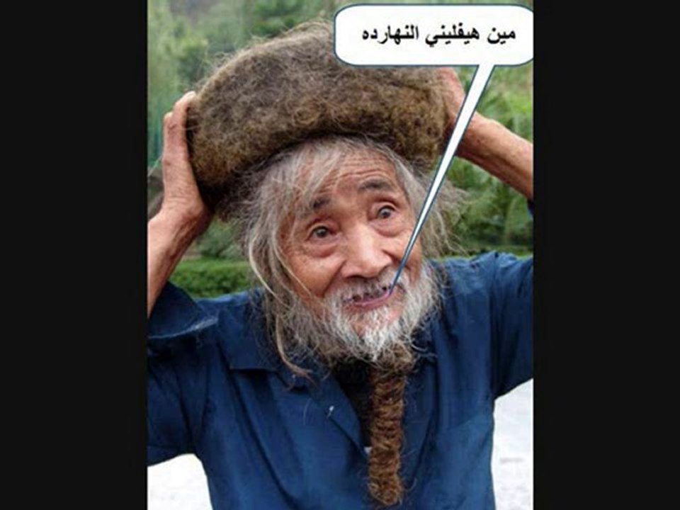 اغنية القمل : راسي بتاكولني وبآسي