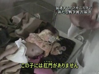 混迷するアフガニスタン 首都カブールで見た 新たな戦争被害