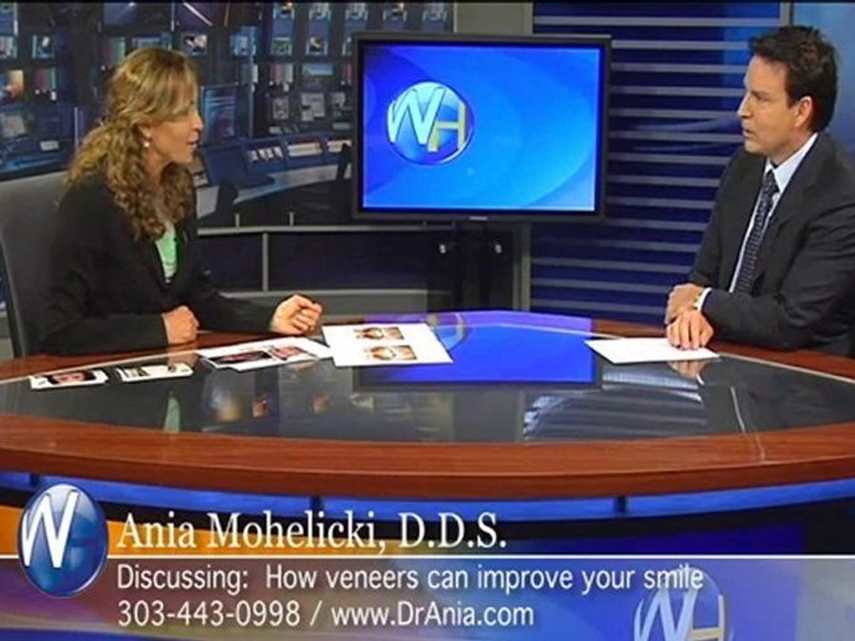 Boulder smile makeover : Dr. Ania