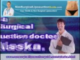 Non Surgical Liposuction Alaska