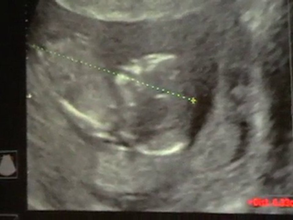 MOV001