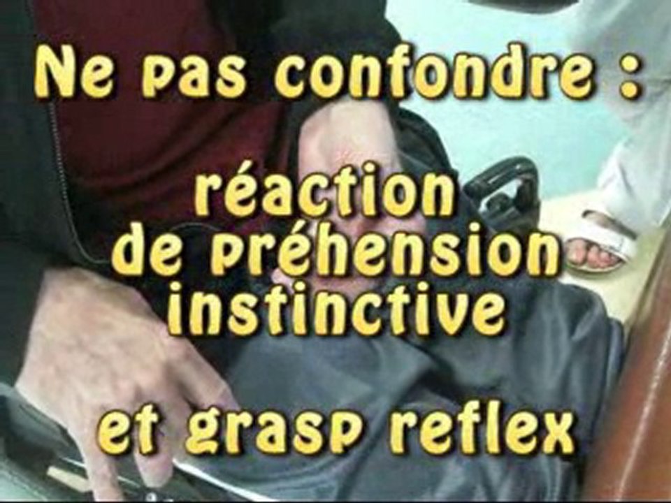 Préhension instinctive et phénomène de gîte (hémiplégie)