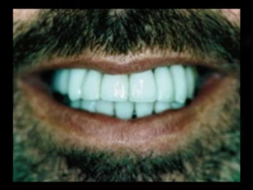 Veneer Dentist Woodland Hills