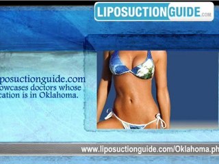 Liposuction Oklahoma