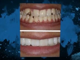 Pick the best Oxford Dentist and right Cosmetic Dentistry O