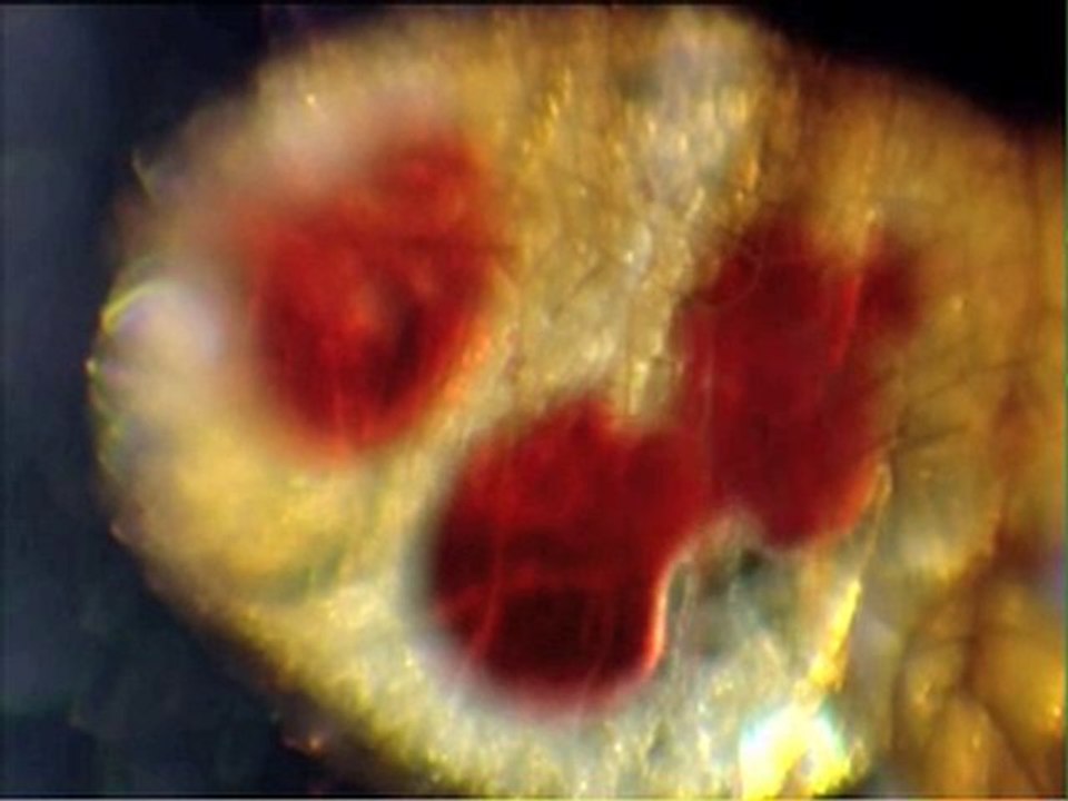 Rothschild ses Puces et la Peste