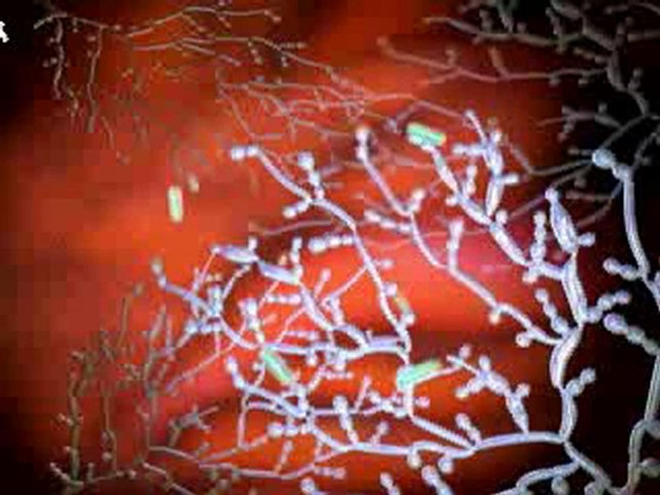 Do You Have  A  Candida Infection?