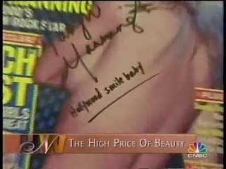 Smile Makeover Dentist of the Celebrities Beverly Hills