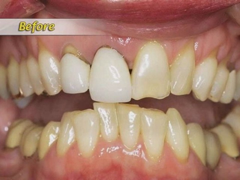 Rocklin Dentist - Stanford Ranch Family Dentistry