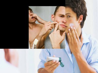 Watch This Natural Acne Cure Make Your Pimples Vanish!