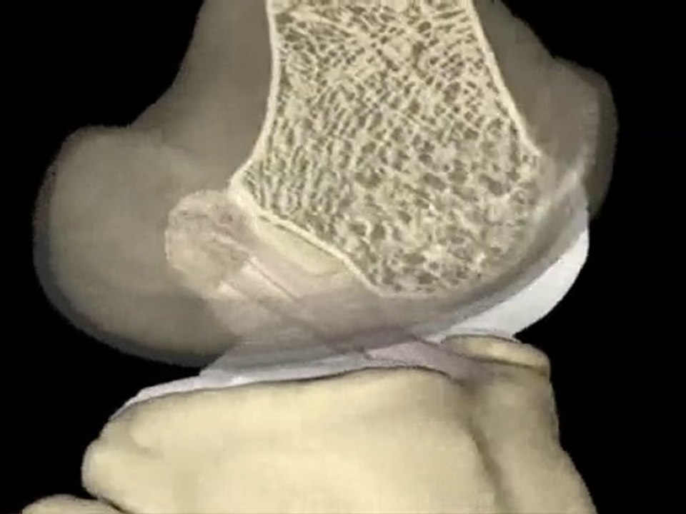 Video Demostrativo de Movimiento de Rodilla