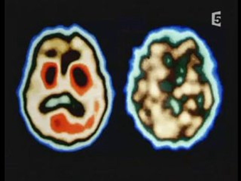 histoire de l'imagerie medicale (3 et fin)