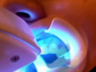 Transform Your Smile with Expert Cosmetic Dentistry in Oxford 😁