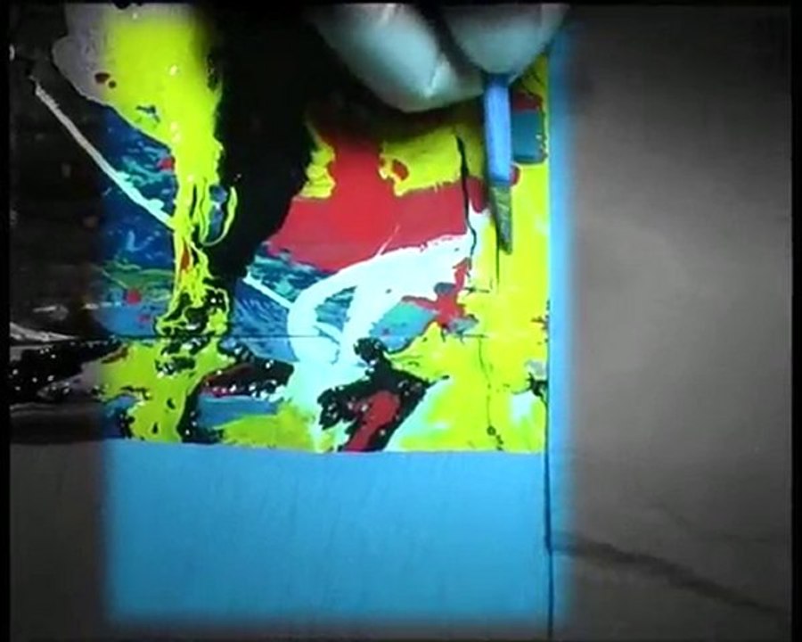 La Césarienne De L'art