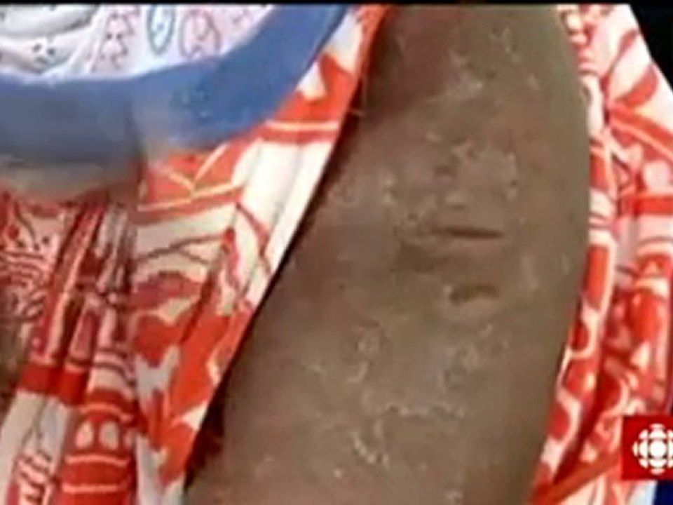 crèmes éclaircissantes